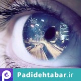 ارتباط رویاهای عجیب با روان‌پریشی