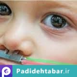انتقال دانش فنی تولید ماشین‌های دیالیز به کشور